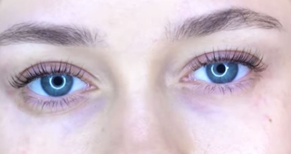 Kit anórthosis kai plastikopoíisis vlefarídon nanolash